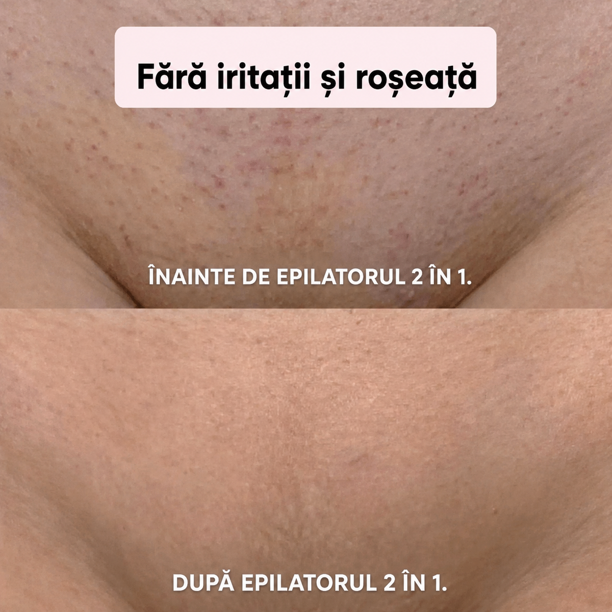 Epilator electric 2in1 pentru corp și zone intime rezistent la apă